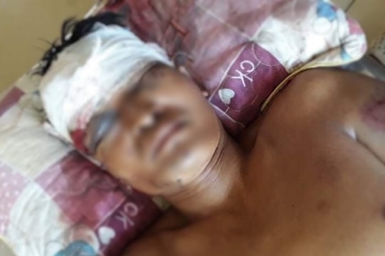 Mời uống rượu rồi đánh đập chủ nợ trọng thương