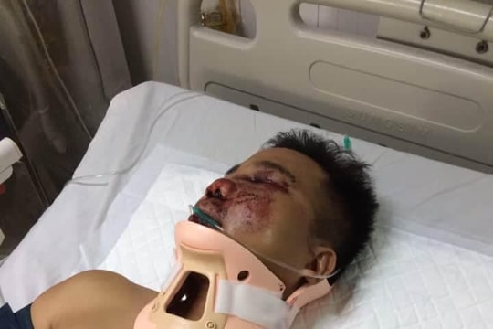 Rơi từ trên mái nhà, nam công nhân Nhà máy tinh bột sắn nguy kịch