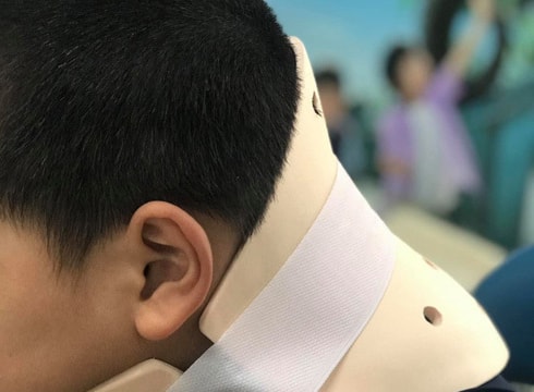 Bé trai 10 tuổi vẹo cổ vì bắt chước video nhào lộn trên mạng