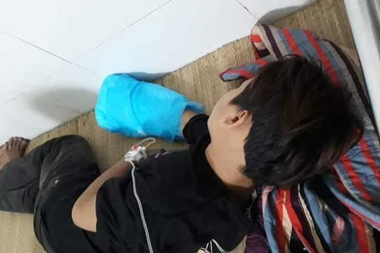 Nghệ An: Tự làm pháo, một nam sinh bị nổ nát bàn tay