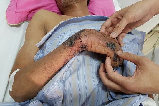 Mổ lợn đánh tiết canh đón Tết - Coi chừng mắc bệnh chết người