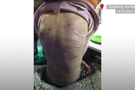 Hai người xâm hại, bạo hành bé gái 12 tuổi bị khởi tố