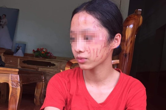 Bênh em gái, hai nữ sinh ở Nghệ An đánh nhau