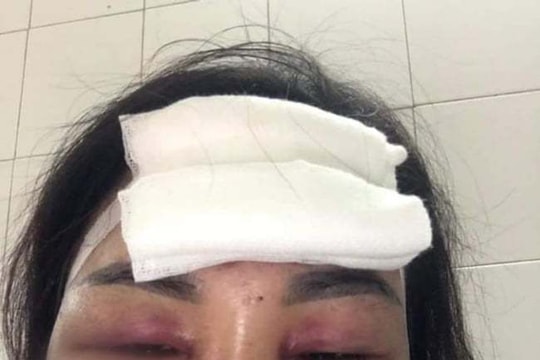 Công an điều tra đơn vợ tố chồng chích điện, dìm xuống ao lúc nửa đêm