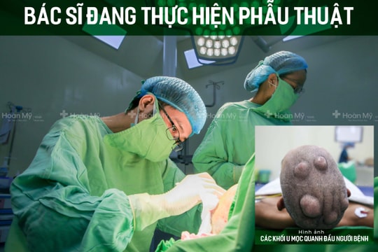 Loại bỏ hơn 10 khối u mọc quanh đầu người đàn ông 46 tuổi
