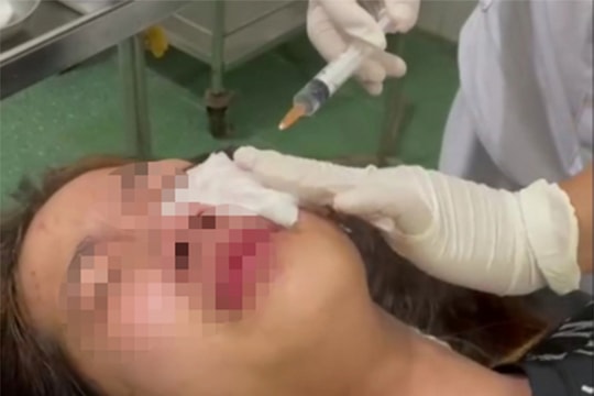 Triệu tập đối tượng xịt hơi cay bỏng mặt nữ sinh