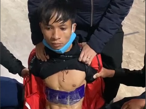 Kiểm tra hành chính đôi nam nữ, phát hiện người đàn ông giấu ma túy quanh bụng