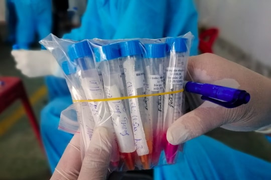 Chiều 18/12, Nghệ An ghi nhận 94 ca nhiễm Covid-19 mới, trong đó có 9 ca cộng đồng