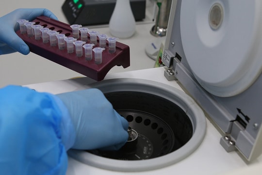 Sáng 17/2, Nghệ An ghi nhận 1.219 ca nhiễm Covid-19 mới, trong đó có 329 ca cộng đồng