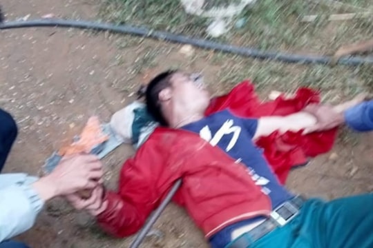 Rơi từ mái nhà xuống, nam thanh niên bị cây sắt lớn đâm xuyên người