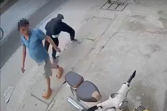 Người đàn ông bị chém lìa chân