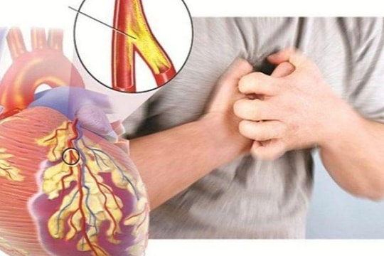 Hút thuốc lá gây nhiều bệnh về tim mạch