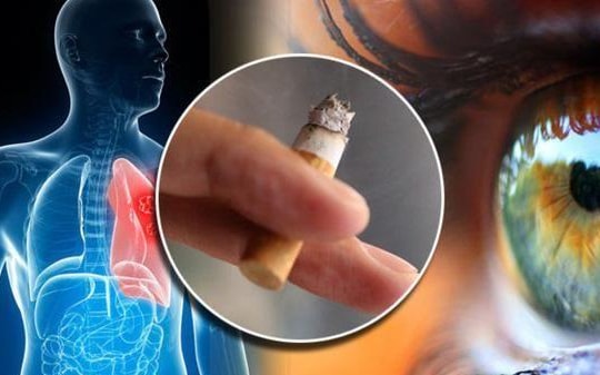 Hút thuốc lá gây ra mù lòa