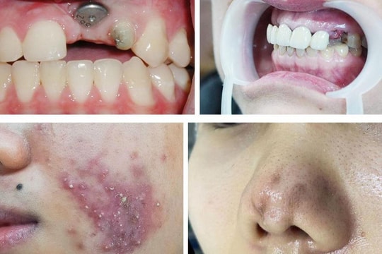 Sự thật đằng sau những dịch vụ chăm sóc sức khỏe và sắc đẹp giá rẻ