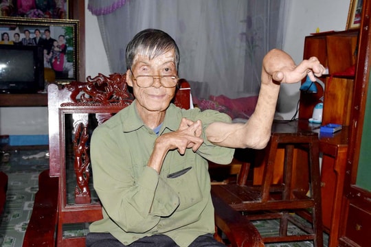 Nghị lực phi thường của cựu binh còn 5% sự sống ở Nghệ An