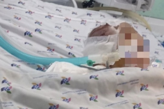 Bảo mẫu đánh bé 6 tháng dập não do 'tức giận nhất thời'