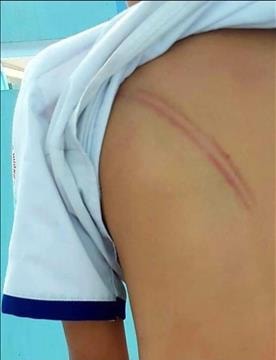 Khởi tố vụ án mẹ kế hành hạ con riêng của chồng