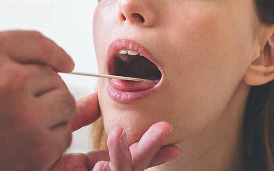 Người phụ nữ phát hiện ung thư từ bất thường ở lưỡi