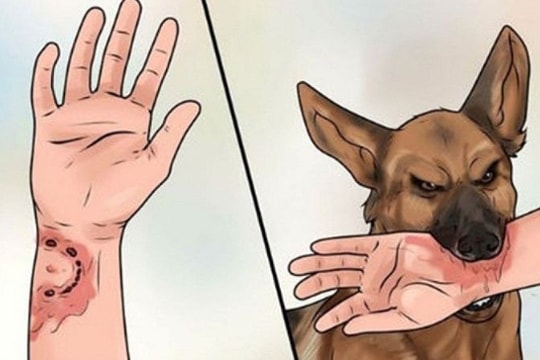 2 trẻ ở Nghệ An tử vong do bị chó dại cắn