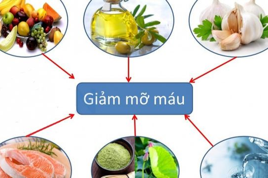 4 chìa khóa quan trọng giúp giảm mỡ máu xấu, bạn đã biết để chủ động phòng bệnh?