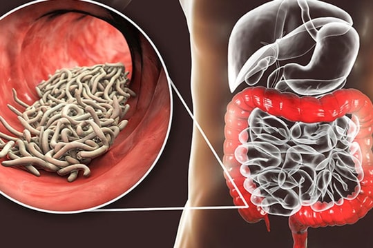 Nghệ An đẩy mạnh công tác phòng, chống bệnh ký sinh trùng