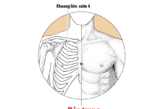 Trị viêm họng mùa hè bằng Đông y