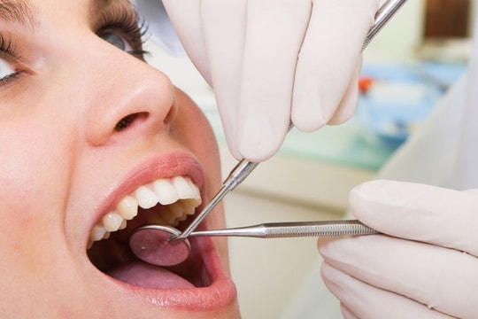 Nhổ răng khôn có thể gặp biến chứng gì?