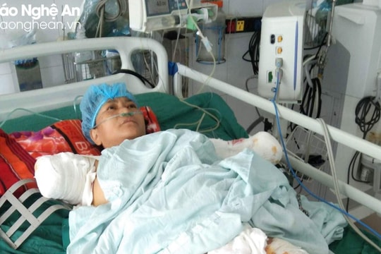 Bị điện giật, người phụ nữ đi giúp việc phải cắt cụt 2 cánh tay