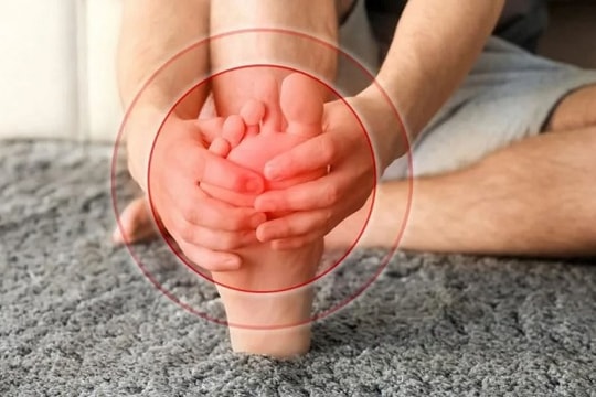 Đau ở bàn chân, tê ngón chân... cảnh giác với u dây thần kinh morton