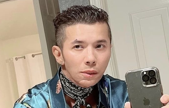 Ca sĩ Kasim Hoàng Vũ xuất hiện với khuôn mặt 'biến dạng'