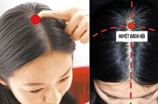 4 huyệt vị giúp làm giảm chứng chóng mặt