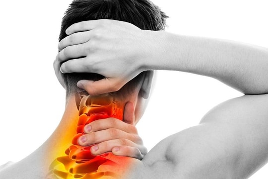 Gai đốt sống cổ: Nguyên nhân, biểu hiện, biến chứng và điều trị