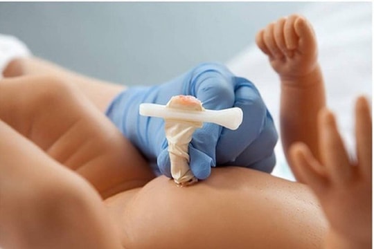 Bệnh viện Sản Nhi Nghệ An cứu sống trẻ sơ sinh bị uốn ván rốn nguy hiểm 