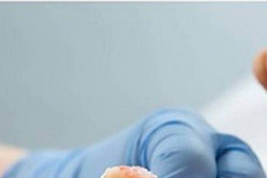 Cứu sống trẻ sơ sinh bị uốn ván rốn 