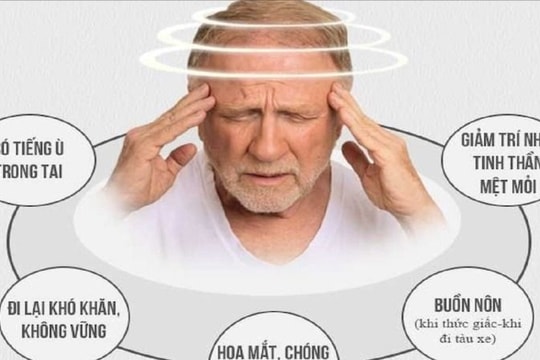 Rối loạn tiền đình có chữa được không?