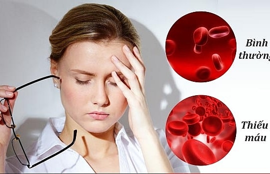 Thiếu máu nên ăn gì tốt nhất?
