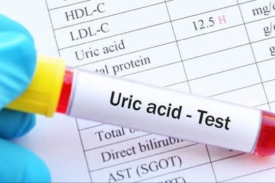 Từ bỏ thói quen ăn uống để hạn chế tăng acid uric