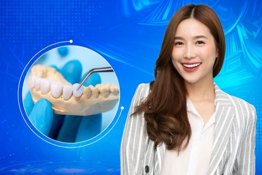 Dán sứ Diamond Veneer - giải pháp thẩm mỹ răng thời đại mới