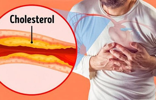 4 loại thực phẩm tốt nhất giúp giảm mức cholesterol