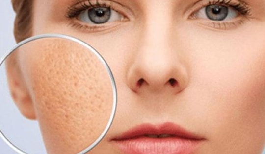 Lợi ích của sữa chua trong làm đẹp