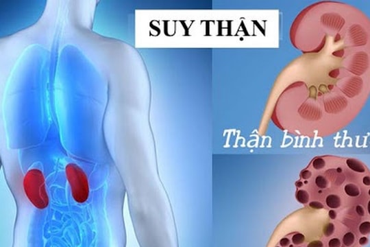 Những bất thường trên cơ thể cảnh báo chức năng thận suy giảm