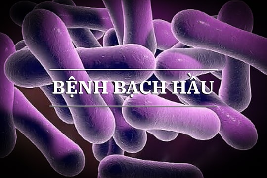 Những con số đáng lưu ý về bệnh bạch hầu