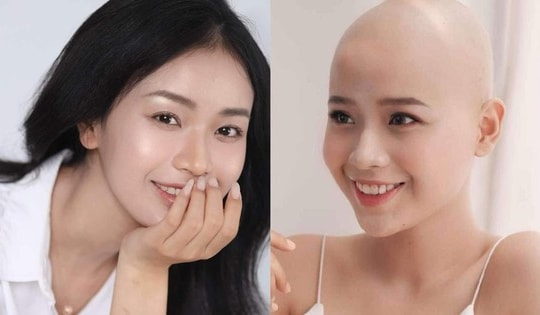 Cô gái từng chiến thắng ung thư nói lý do thi Miss Grand Vietnam