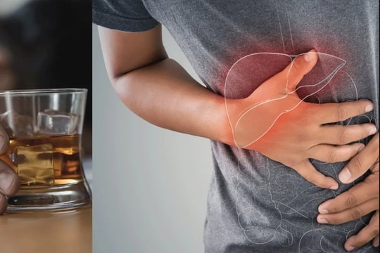 Phải mất bao lâu để gan đào thải hết rượu?