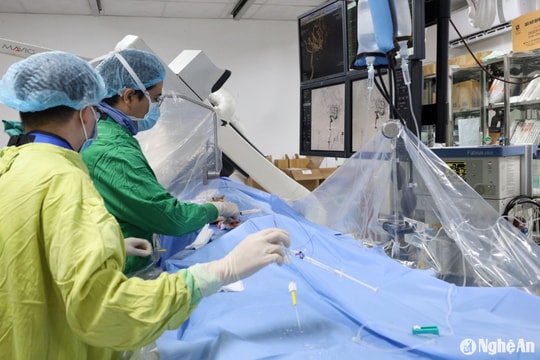 Bệnh viện Hữu nghị Đa khoa Nghệ An can thiệp nút mạch não bằng vòng xoắn kim loại cho bệnh nhân