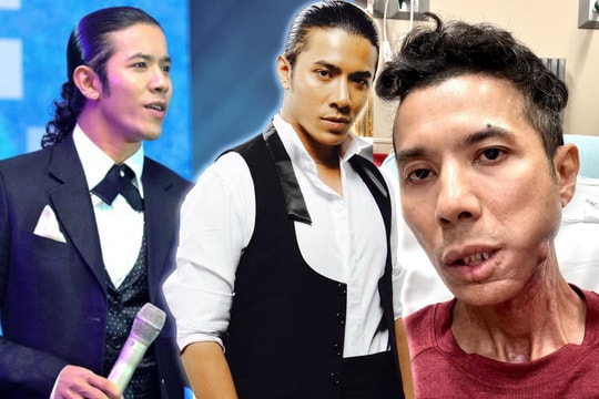 Kasim Hoàng Vũ: 'Nam thần nhạc rock' trở nên tiều tụy vì bạo bệnh
