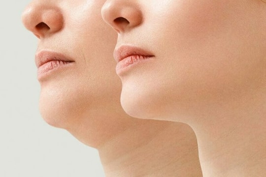 Bài tập giúp bạn thoát tình trạng cằm đôi khó chịu