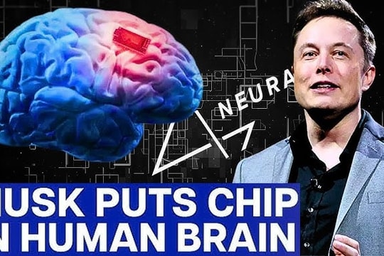 Neuralink của Elon Musk: Bước đột phá với thử nghiệm sử dụng cấy ghép não điều khiển cánh tay robot