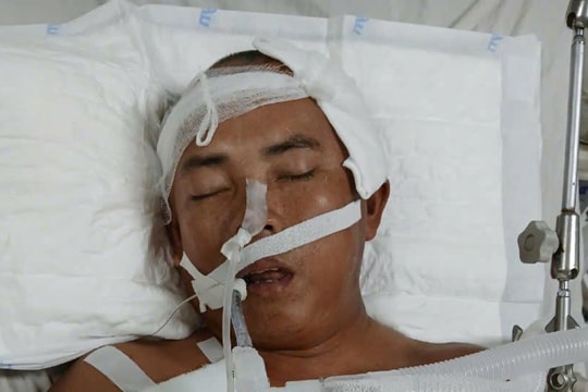 Nỗi khốn khổ của người đàn ông đi bốc gỗ keo thuê