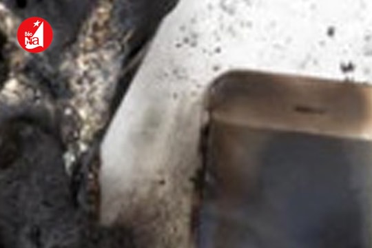 Người đàn ông ở Tương Dương bị bỏng nặng nghi do điện thoại phát nổ khi sạc